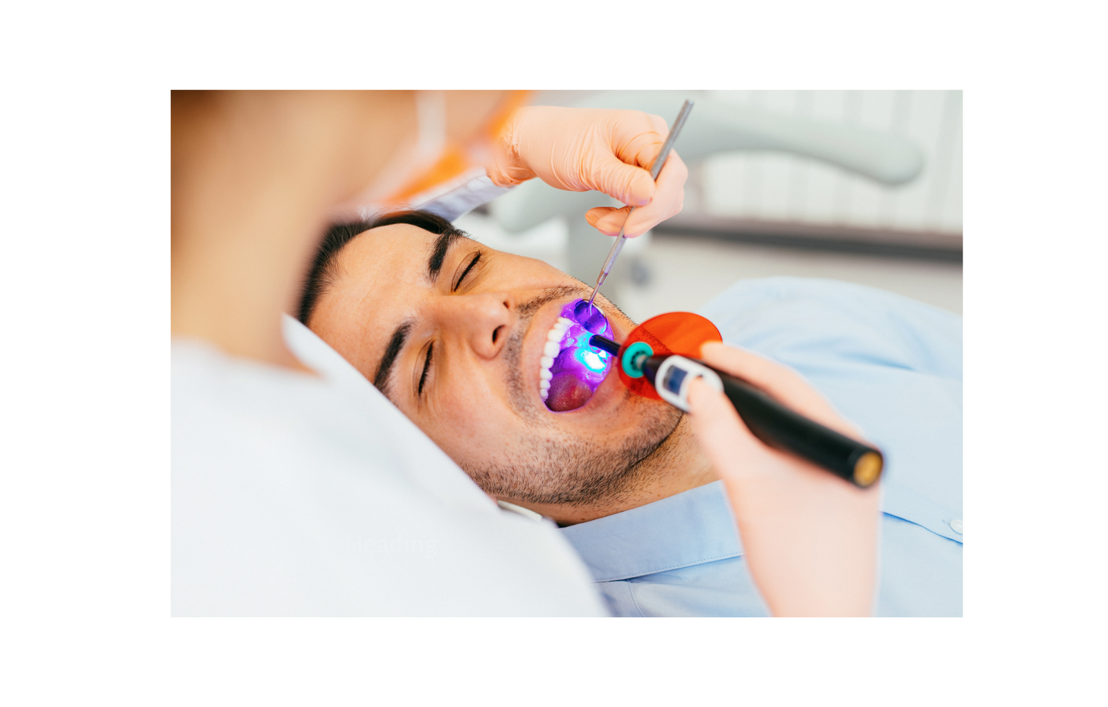 The Importance of Choosing the Right Dental Curing Light for Your Practice