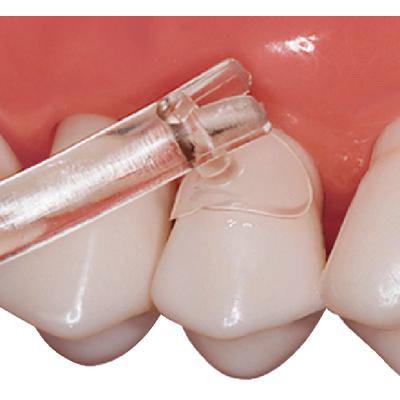 Cure-Thru® Clear Cervical Matrices - 3Z Dental